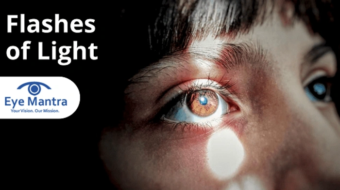 Daily Life with Flashes in the Eyes