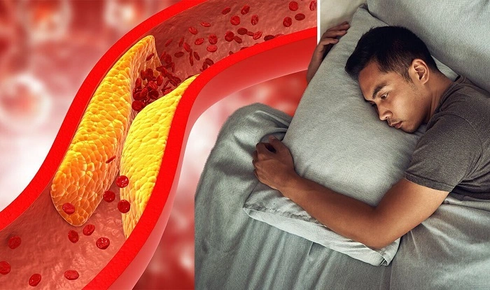 Sleep and Cholesterol