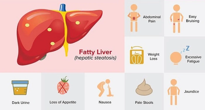 Treatment of Hepatic Steatosis