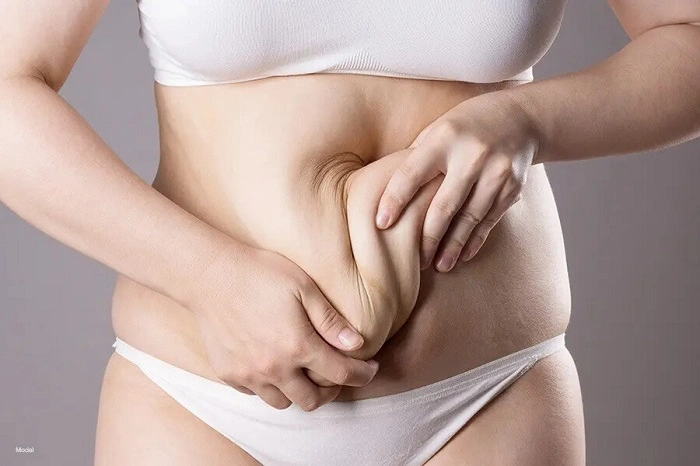 Who is a Good Candidate for a Tummy Tuck