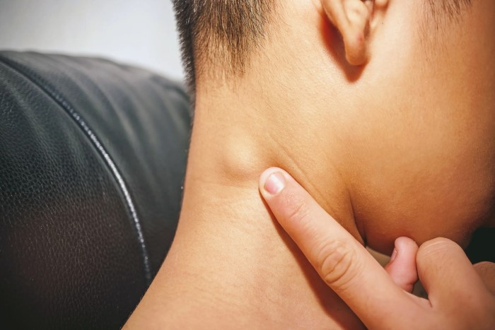 Why Lumps Form in the Neck